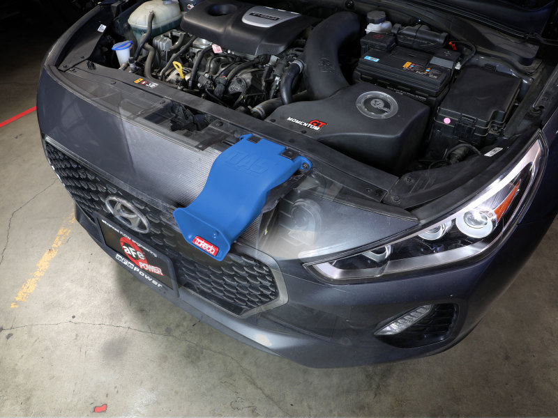 AFE 56-70005SL fits Hyundai Elantra GT L4-1.6L (t) Takeda Momentum Dynamic Air