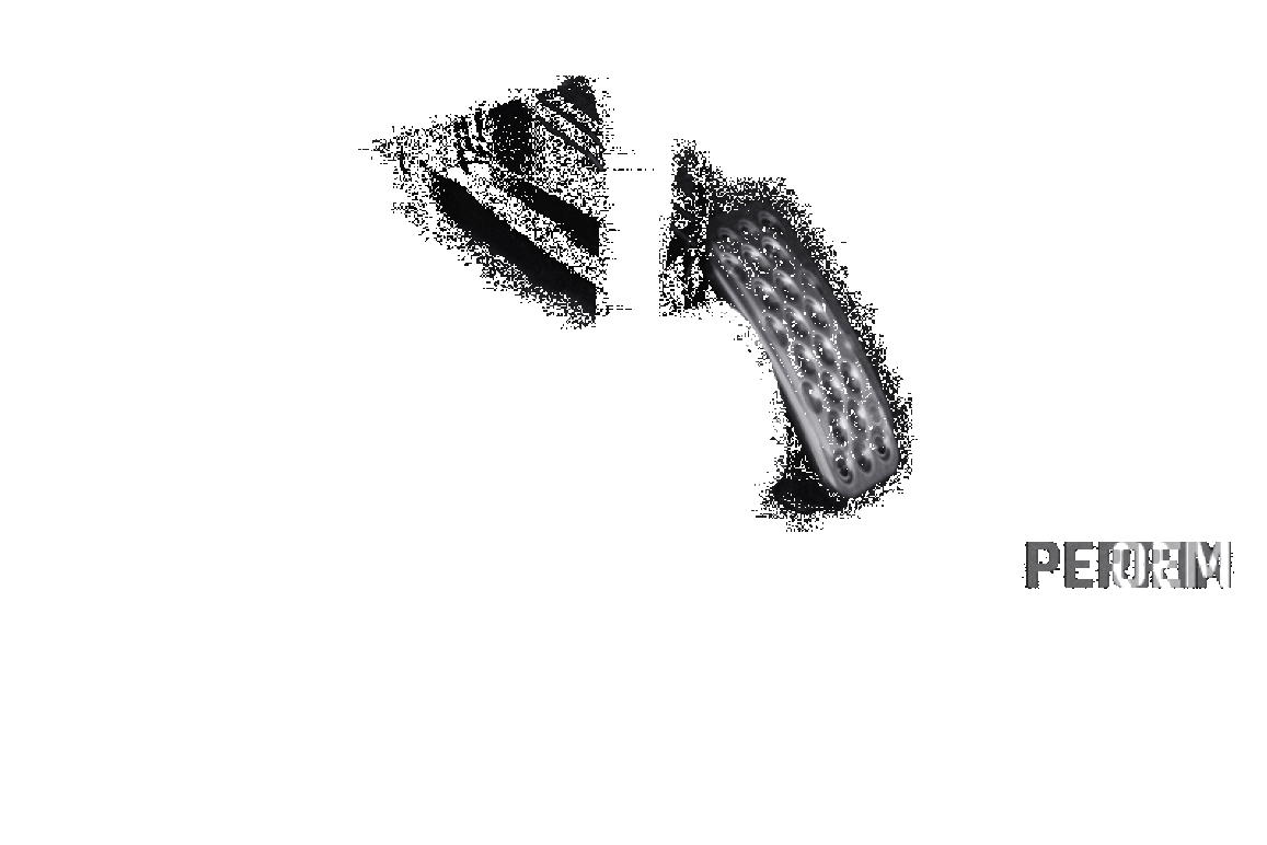 PERRIN PHP-DRV-088 fits Honda 17-19 fits Civic Si / Type R Accelerator Pedal